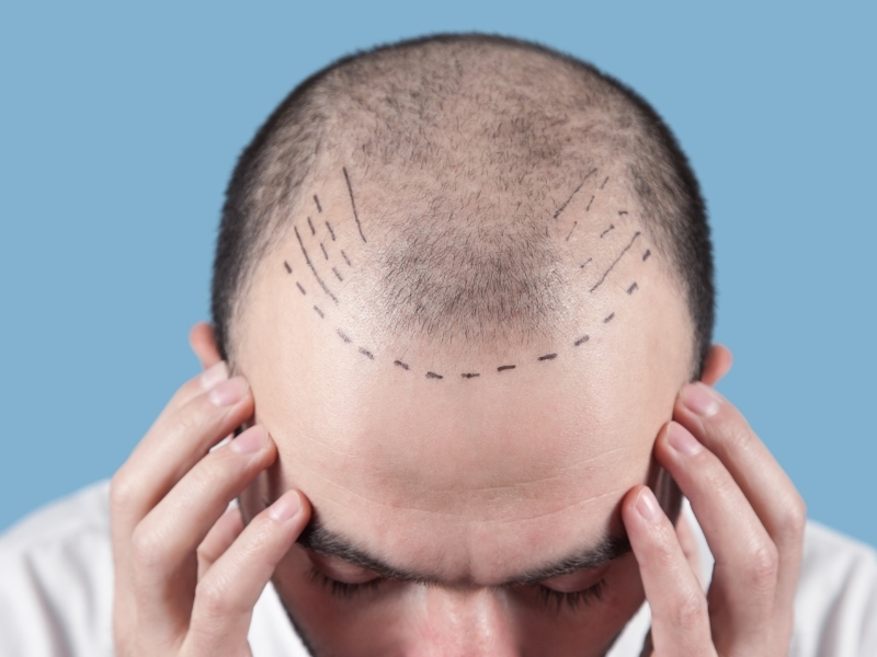 İstanbul Hair Center