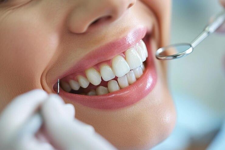 Bursa Smile
